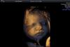 3d_visage_3