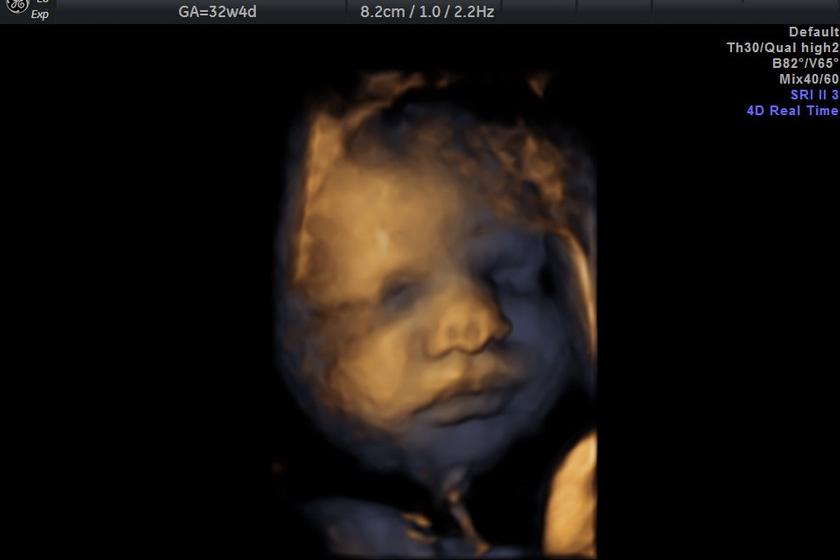 3d_visage_3