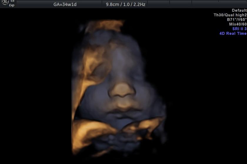 3d_visage_4