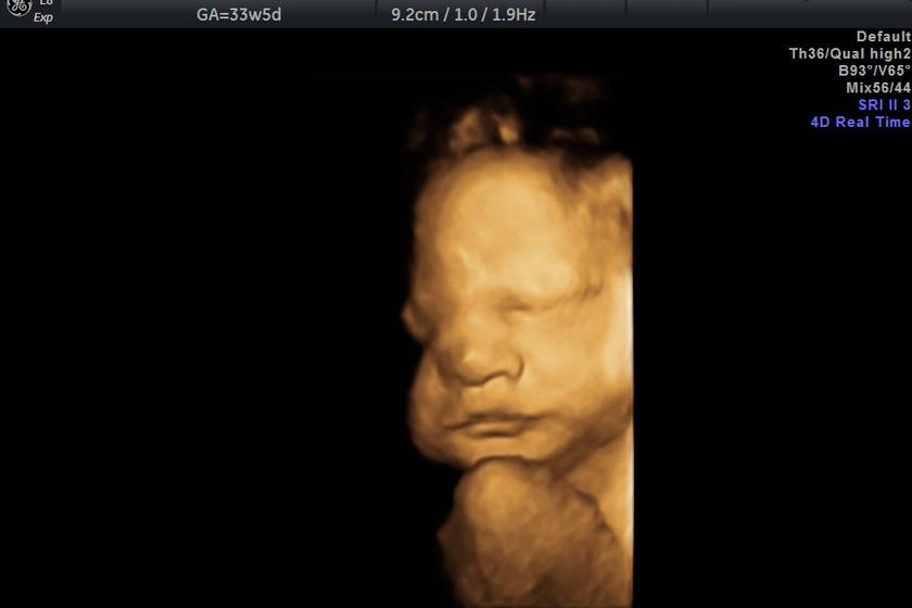 3d_visage_clean