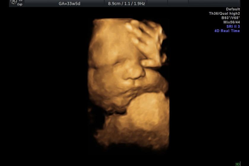 3d_visage_main_3