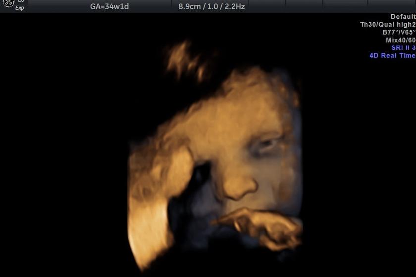 3d_visage_oeil
