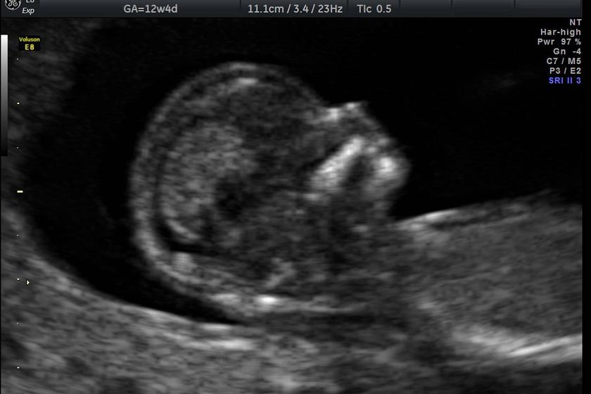 profil_2
