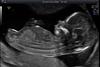 profil_3