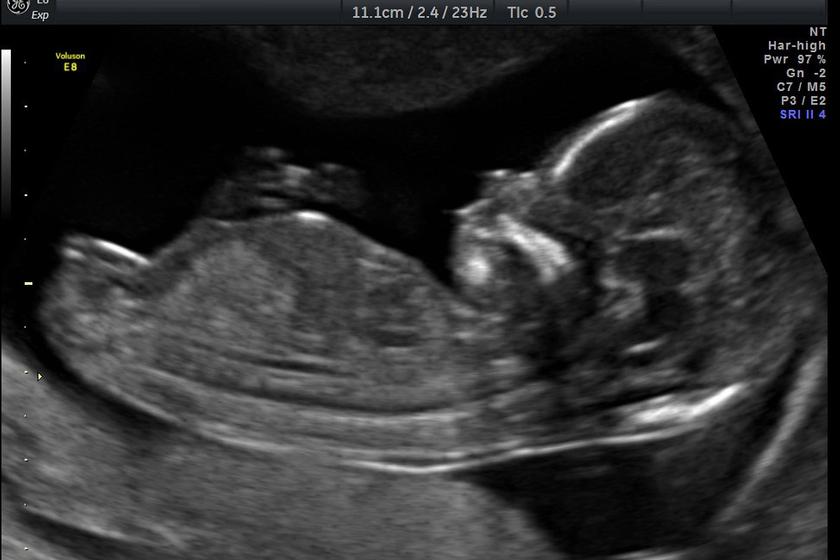 profil_3